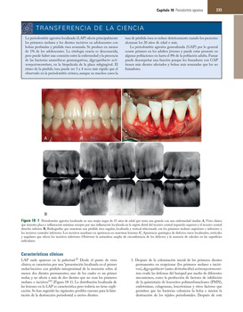 Periodontologia Clinica Carranza 10 Edicion Pdf Free